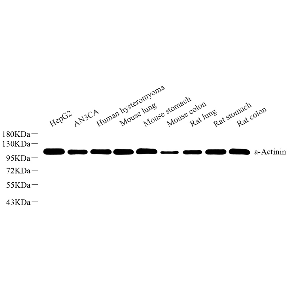 Anti -GAPDH Mouse mAb