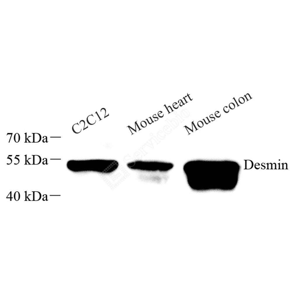 Anti -Desmin Mouse mAb