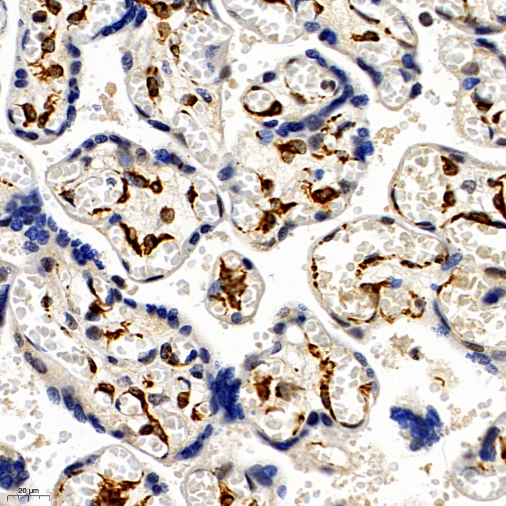 Anti -CCRL2 Rabbit pAb