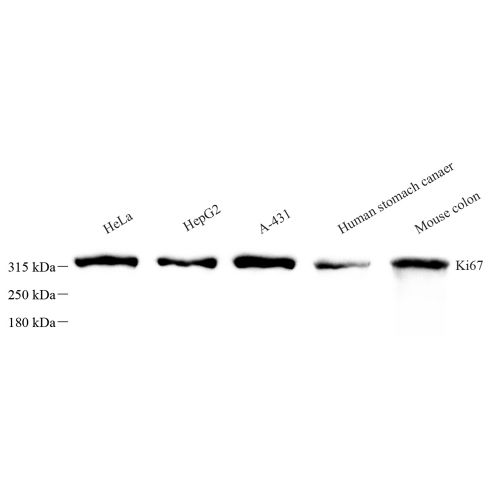 Anti -Ki67 Rabbit pAb