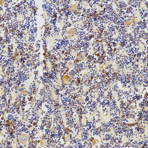 Anti -Osteoprotegerin Rabbit pAb