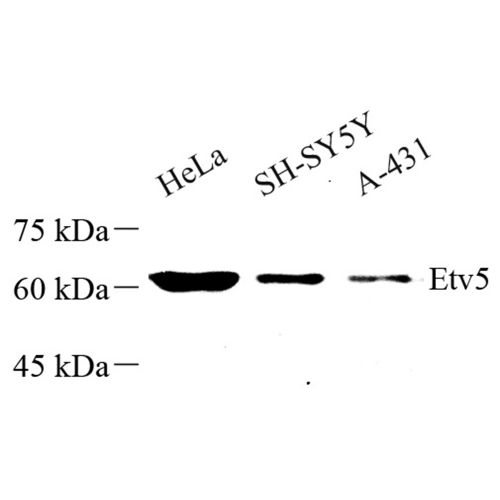 Anti -ERM / Etv5 Rabbit pAb