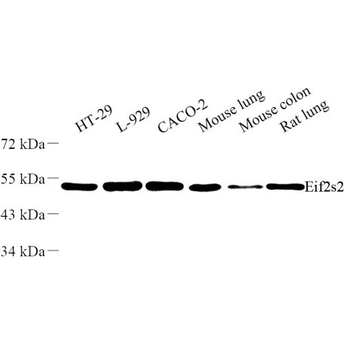 Anti -EIF2S2/EIF2B Rabbit pAb